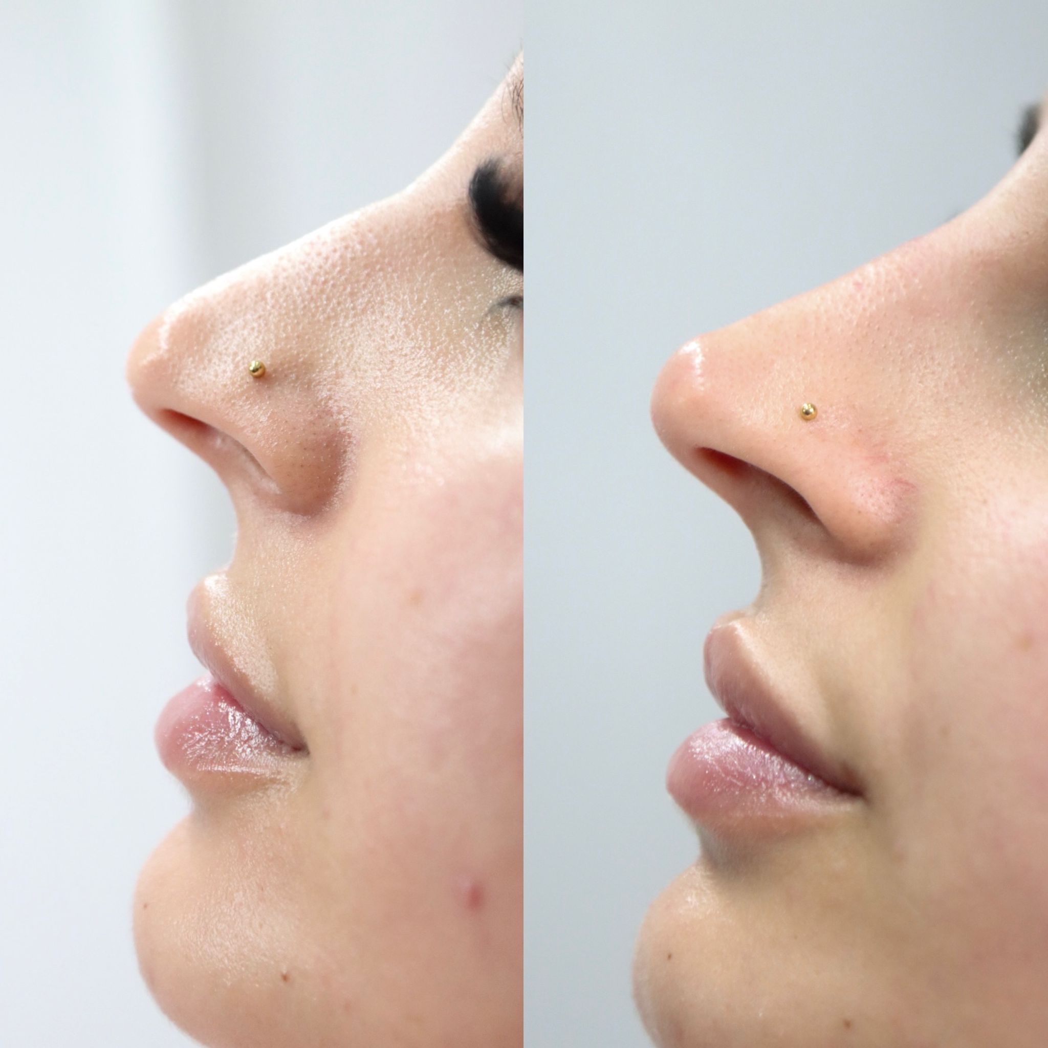 Treatment result 4