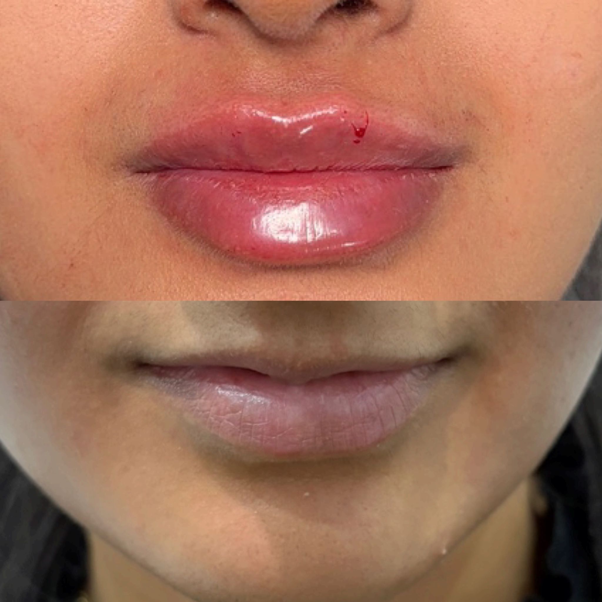 Treatment result 6
