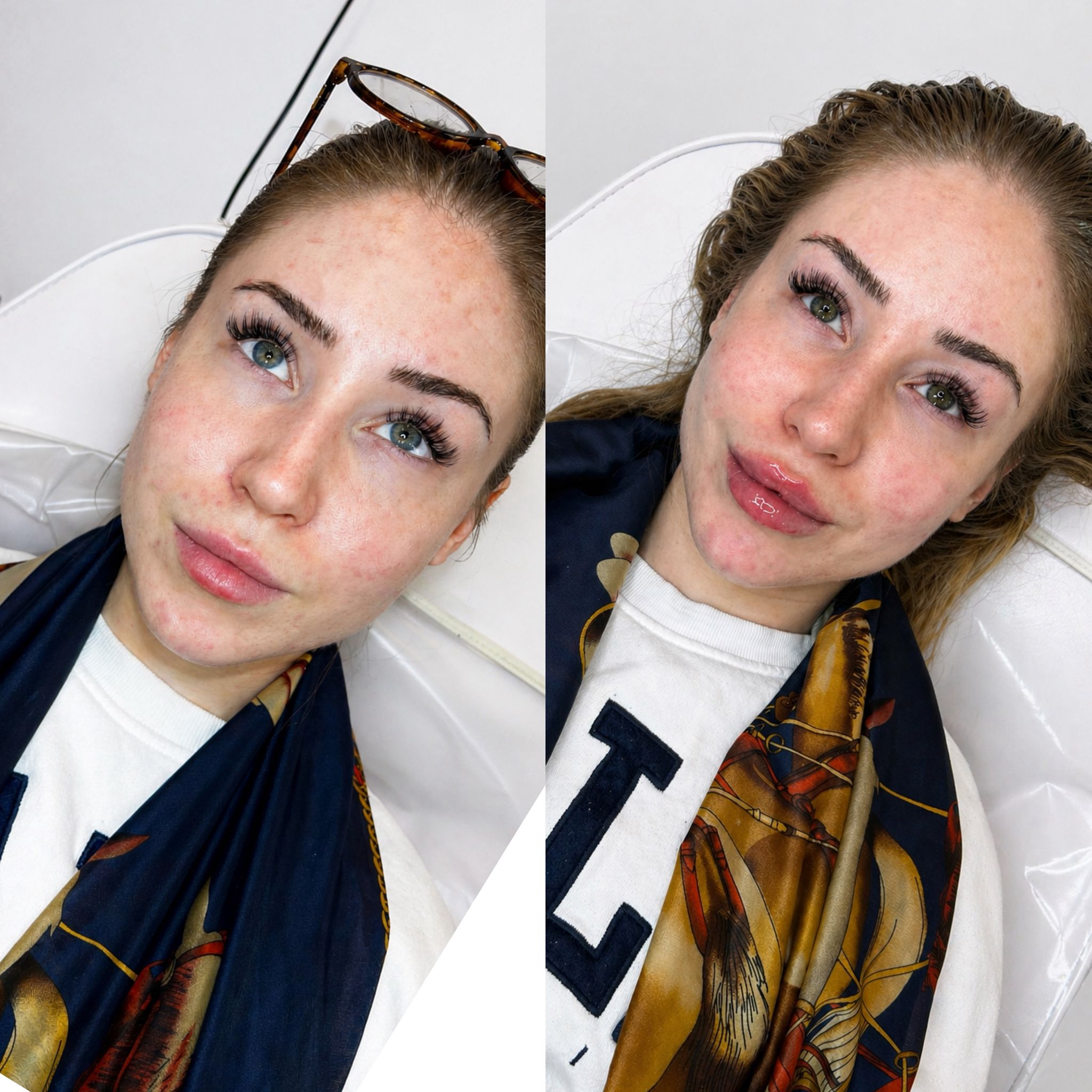 Treatment result 1