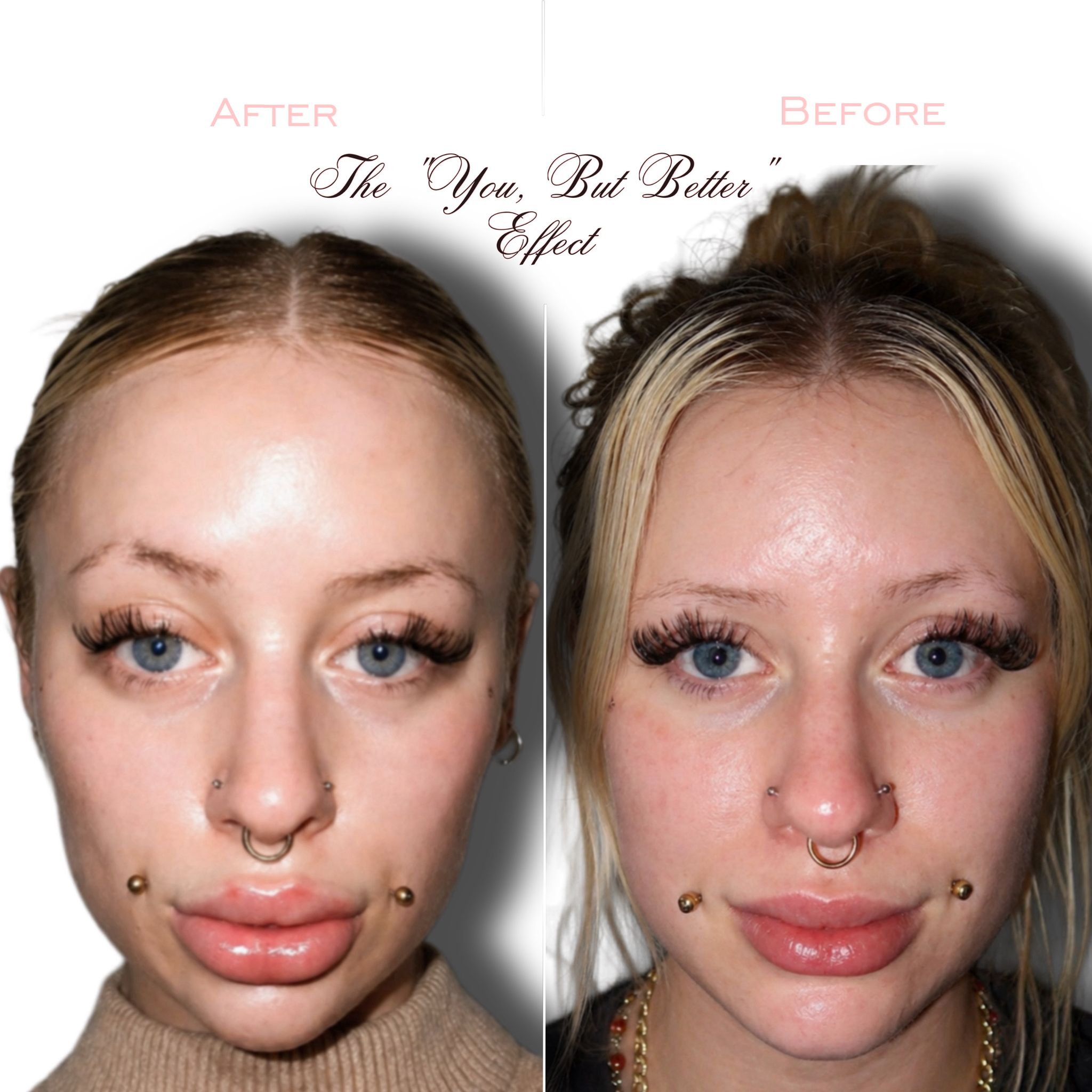 Treatment result 2
