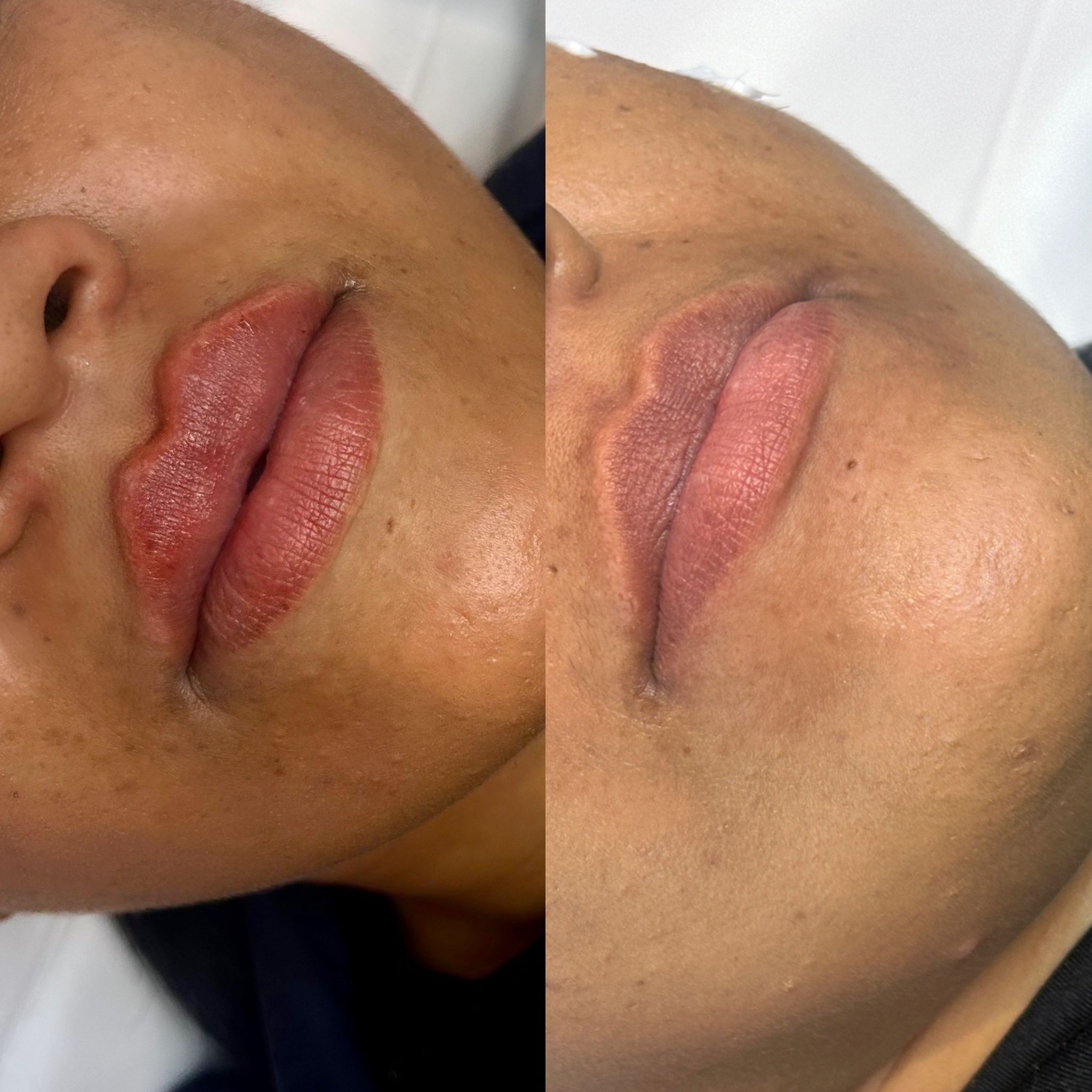 Treatment result 5